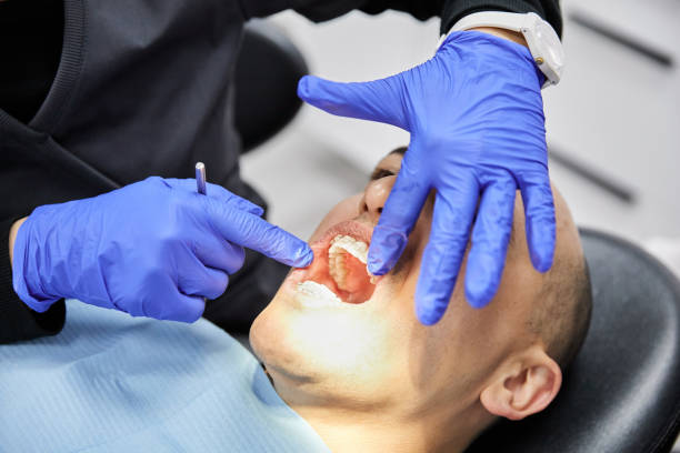 Best Emergency Denture Repair in Westchase, FL